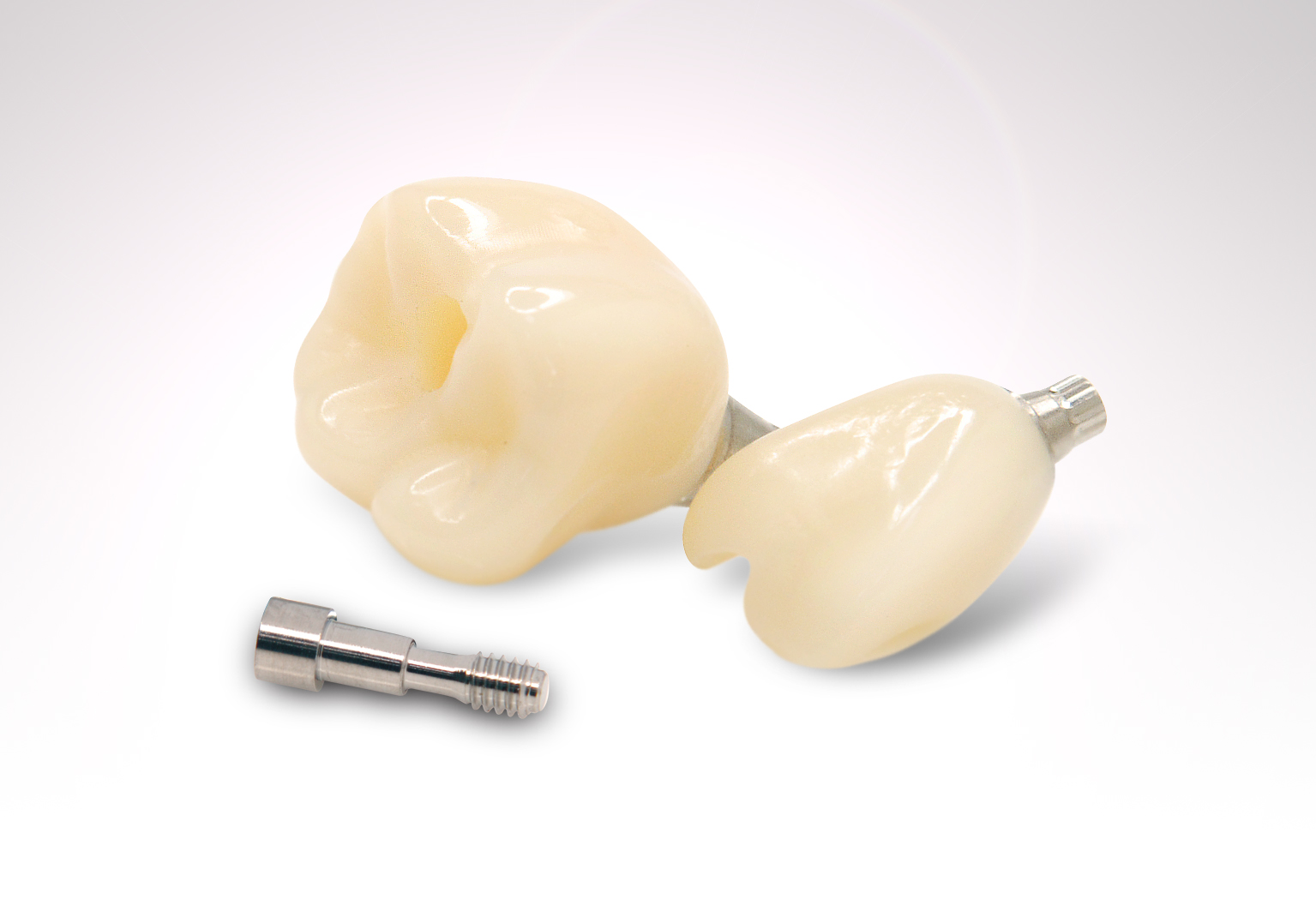 Crown Bridge Exquisite Dental Tech Crown bridge exquisite dental tech